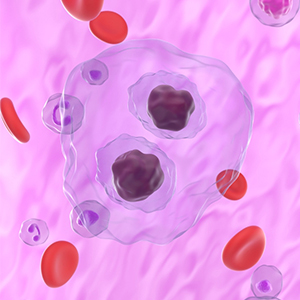 Hodgkin lymphoma